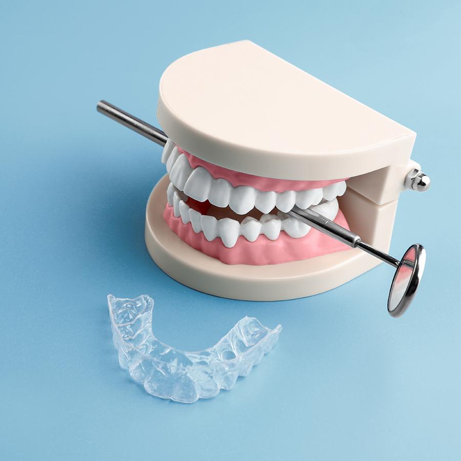 Affordable teeth clenching treatment from Ross Dental
