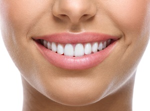 Clear smail with invisalign