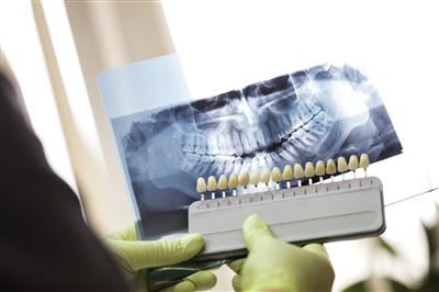 Contact Ross Dental today for a free cosmetic consultation Teeth whitening in Milwaukee area