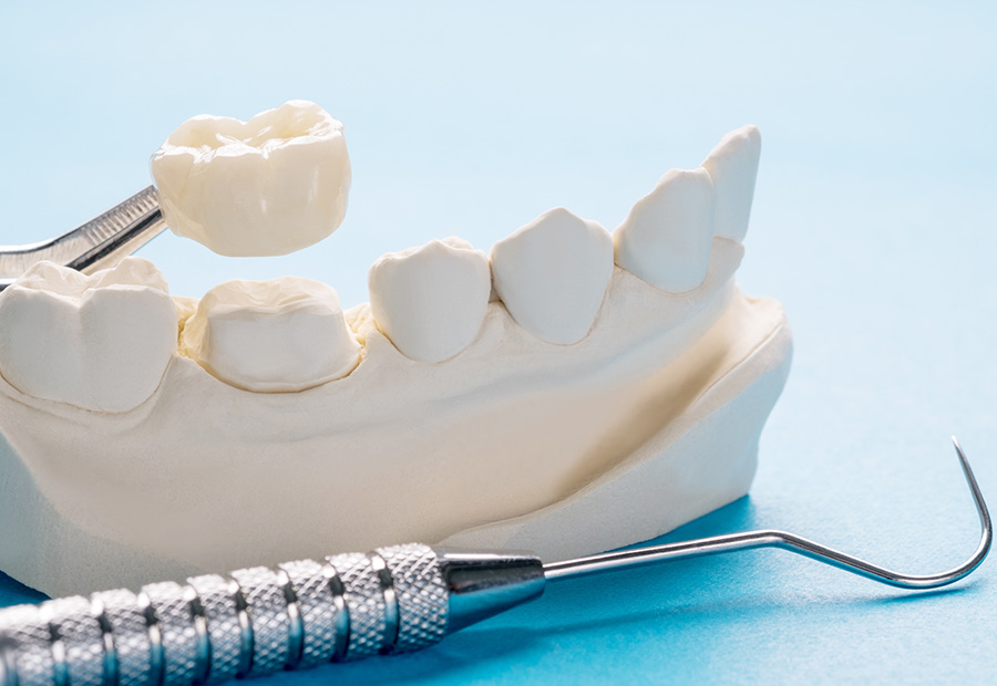 affordable dental crowns in waukesha