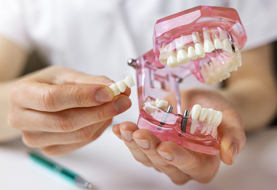 dental implants in Waukesha, WI